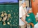 Indian Teenager Has 232 Teeth Removed In A ‘World Record’ Operation!