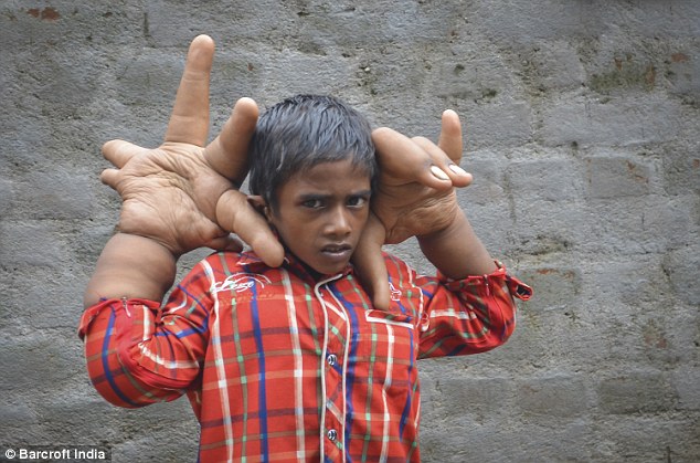 kaleem, giant hands, viral affairs